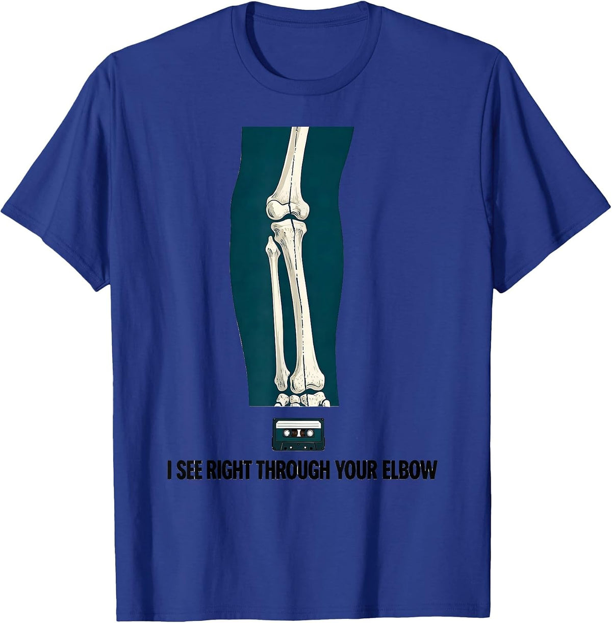 Men's I See Right Through Your Elbow Funny Radiology Tech Humor T-Shirt - Royal Blue