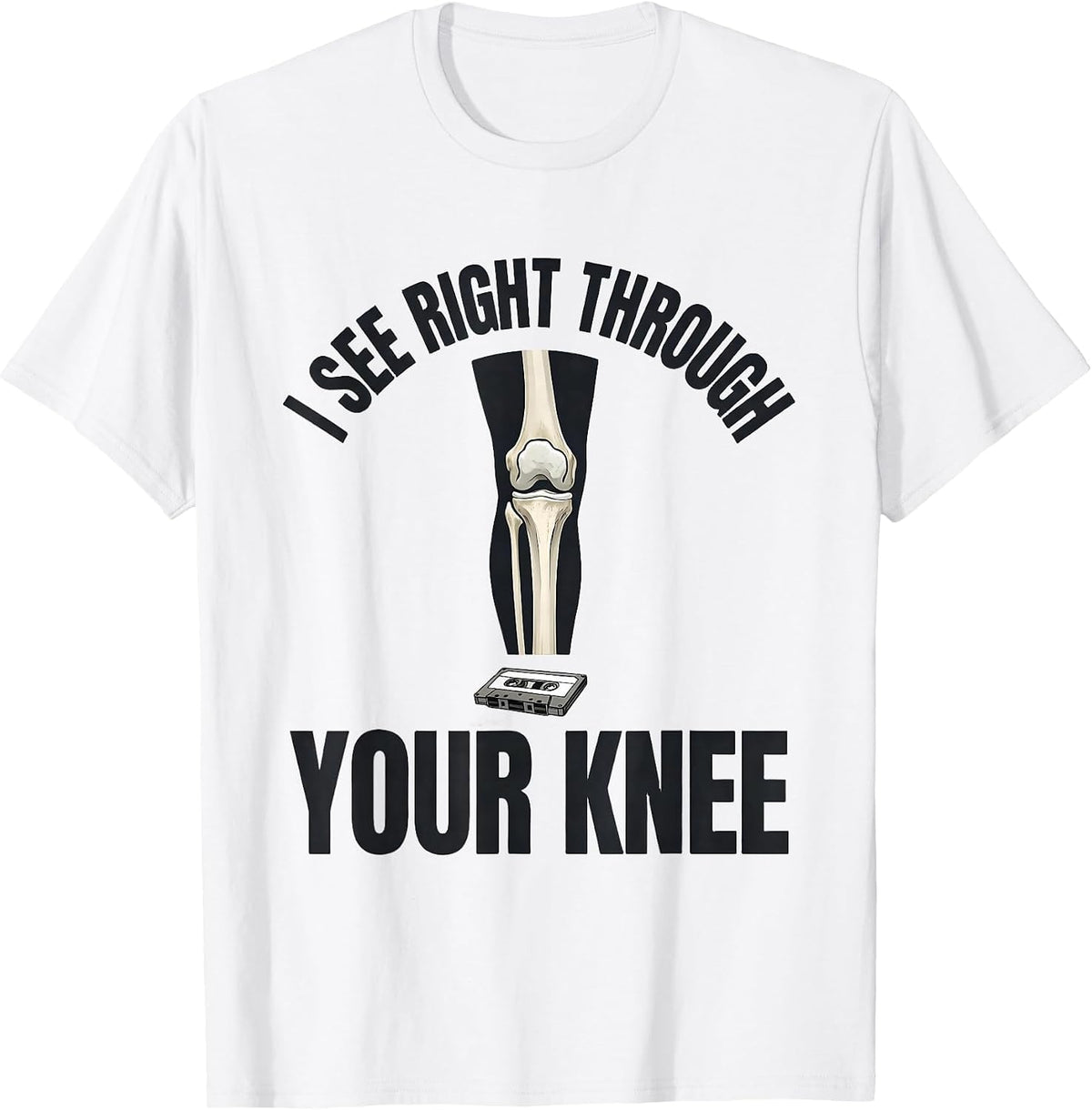 Men's I See Right Through Your Knee Funny Radiology Tech X-ray T-Shirt - White