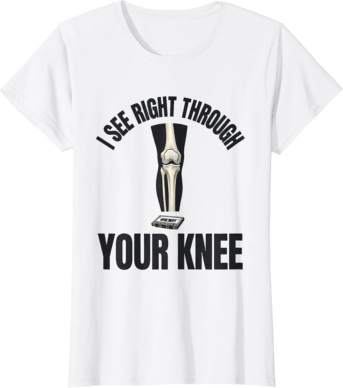 Women's I See Right Through Your Knee Funny Radiology Tech X-ray T-Shirt - White