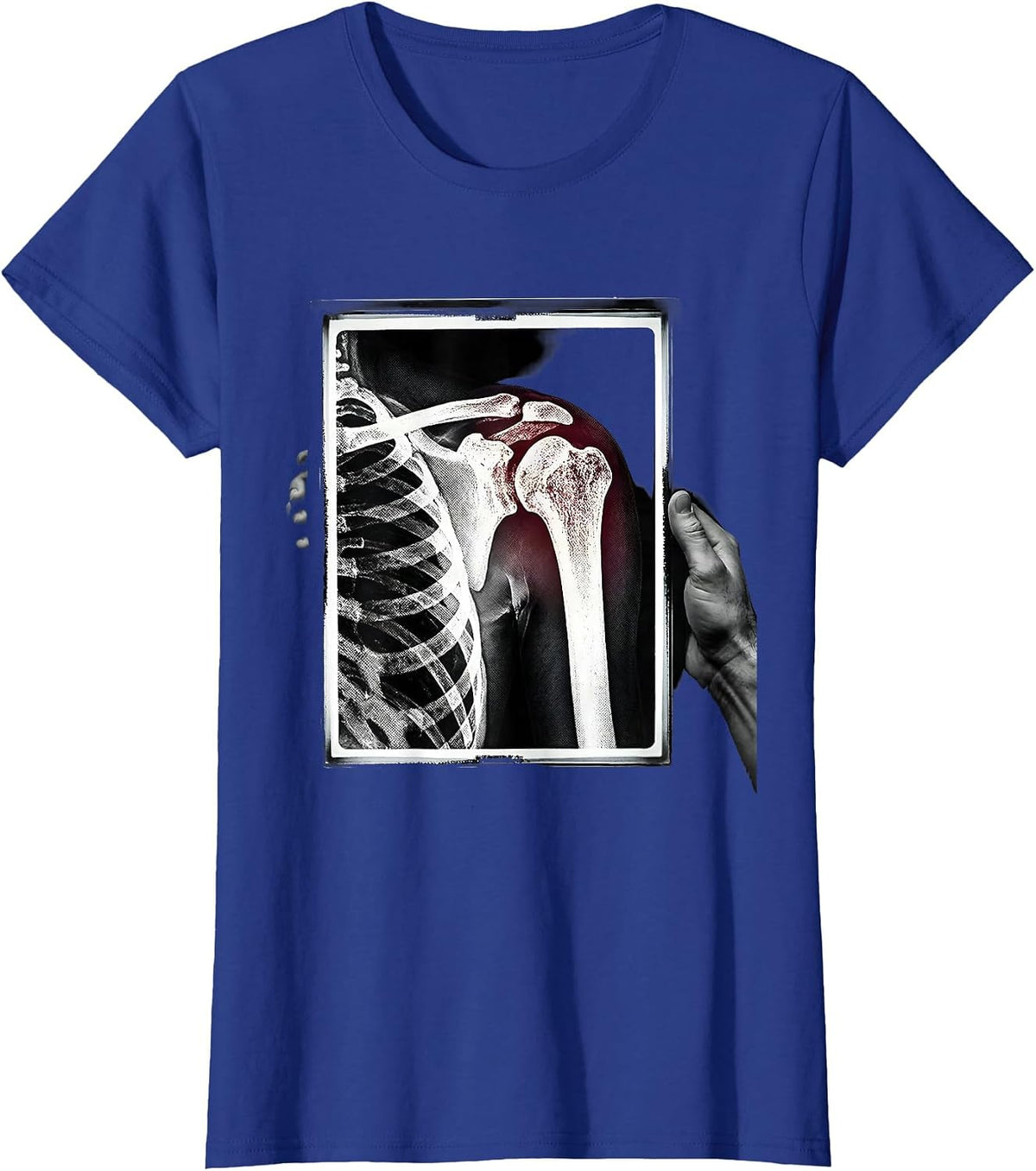 Women's Radiographic Detector Shoulder Joint Radiology Tech Humor T-Shirt - Royal Blue