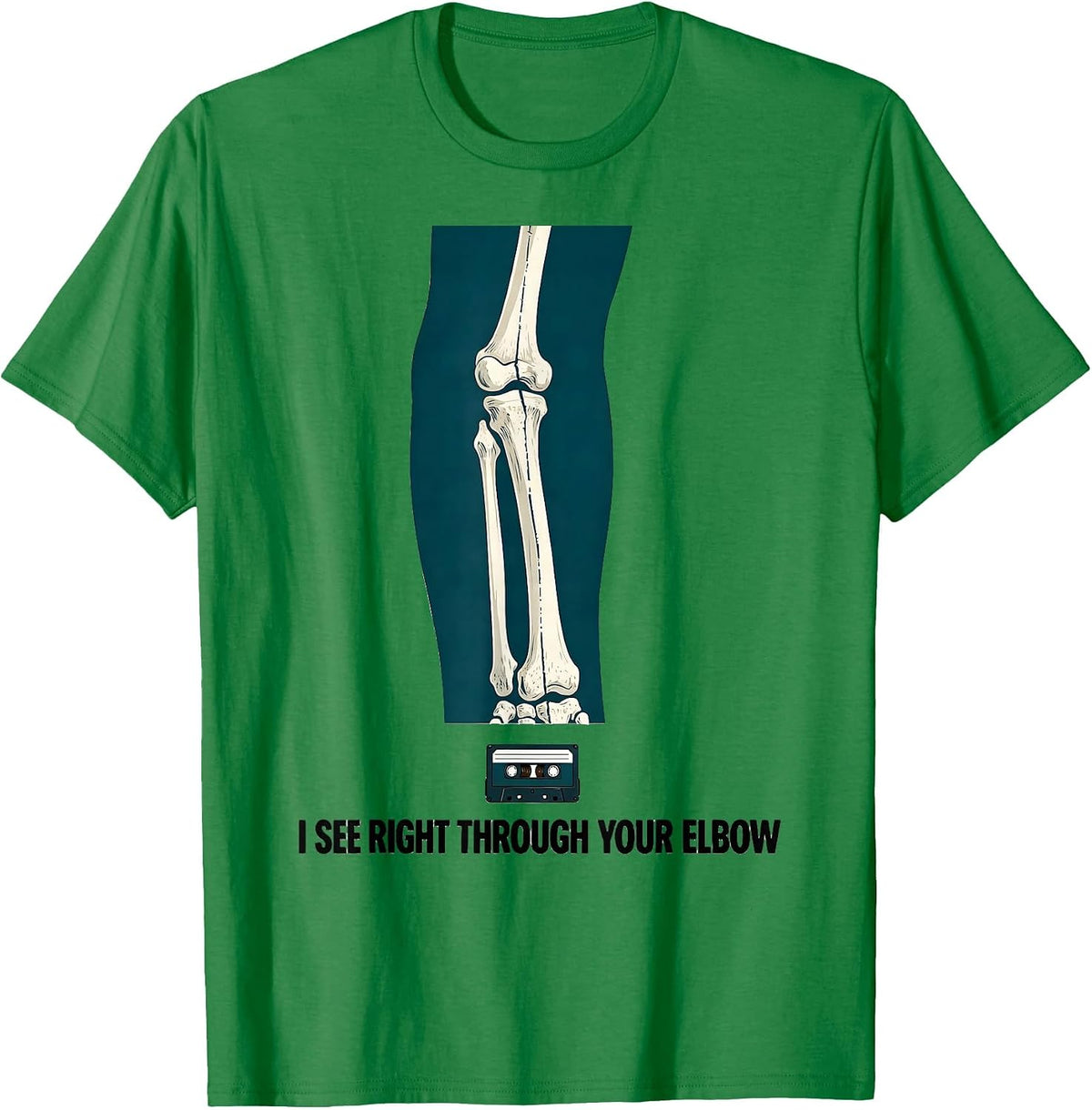 Men's I See Right Through Your Elbow Funny Radiology Tech Humor T-Shirt - Kelly Green